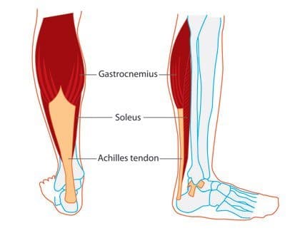 Knee Pain