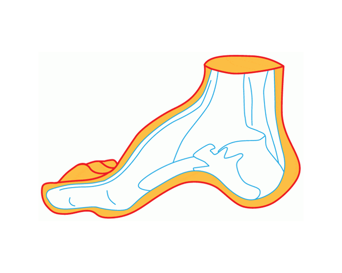 Foot support illustration
