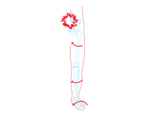 Knee Pain