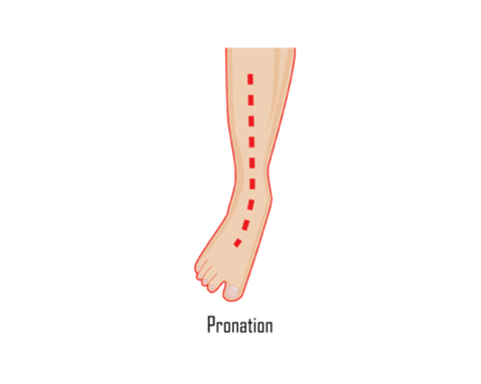 Foot support illustration