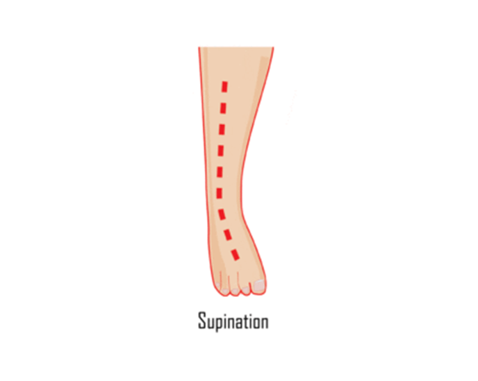 Foot support illustration