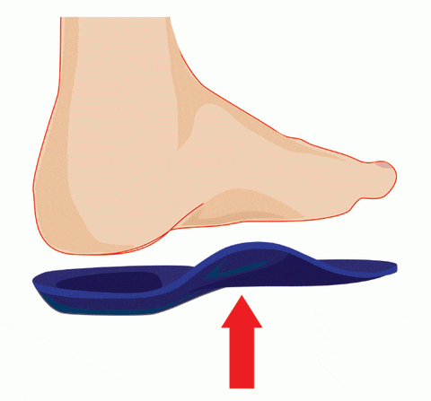 How orthotic support works with the foot
