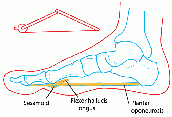 The Windlass Mechanism in the Foot and Foot Pain - Docpods Australia