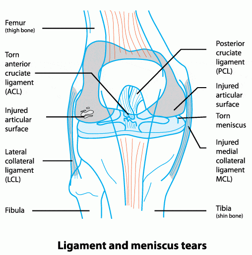 Articular Cartilage Damage - Docpods Australia